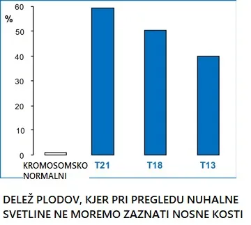Odsotnost nosne kosti pri plodu